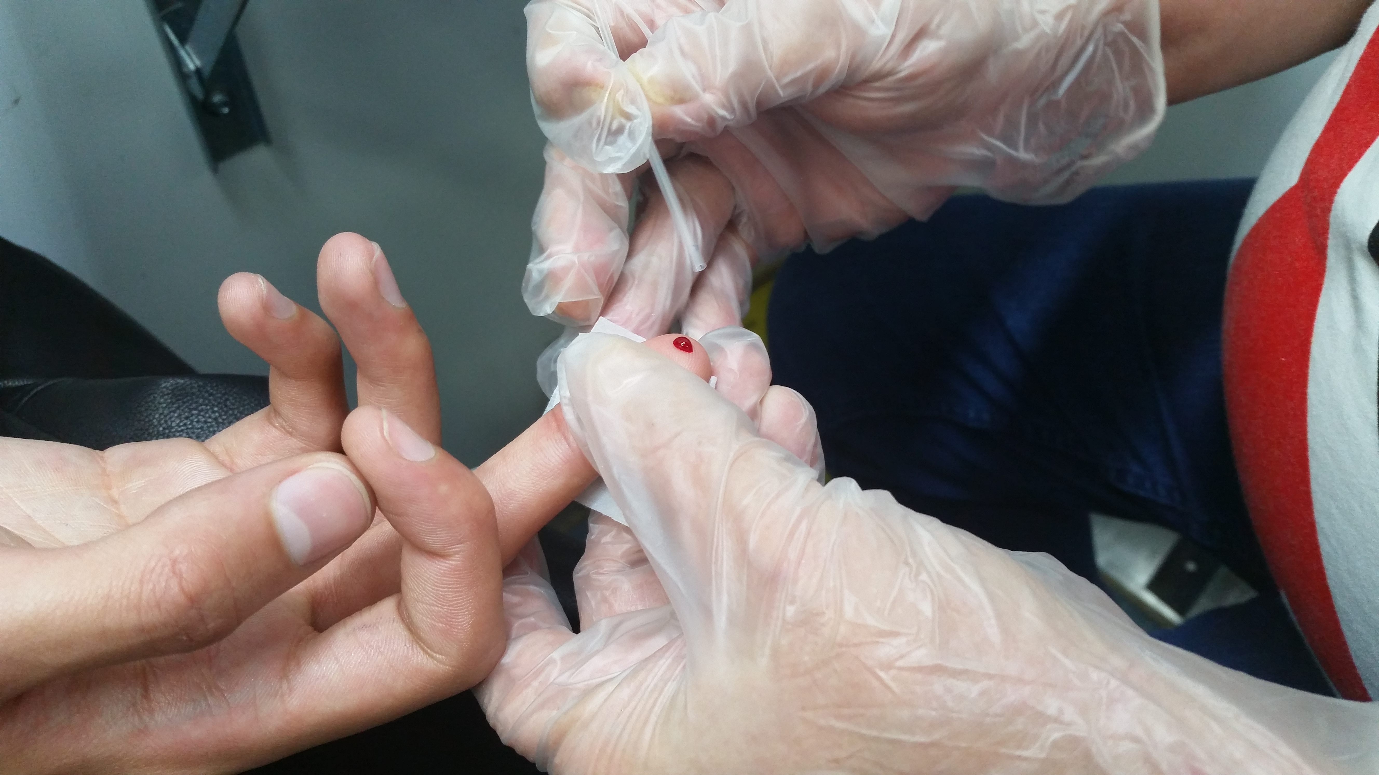 Foto que mostra a coleta de sangue de um dedo com um bastão transparente. A coleta é feita por uma mão com luva transparente, ao centro da imagem.