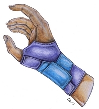 Desenho de mão com tipóia nas cores roxo e azul.