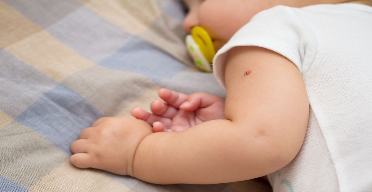 bebê deitado de bruços com foco no braço com a marca da vacina bcg