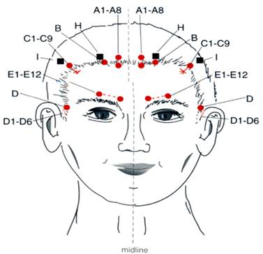 Ilustração de um crânio com os pontos da craniopuntura