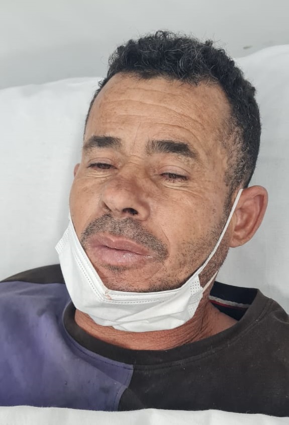 Homem pardo, cabelos pretos, olhos castanho escuros, com barba, está deitado sobre uma maca, com uma máscara de proteção facial sob o queixo.