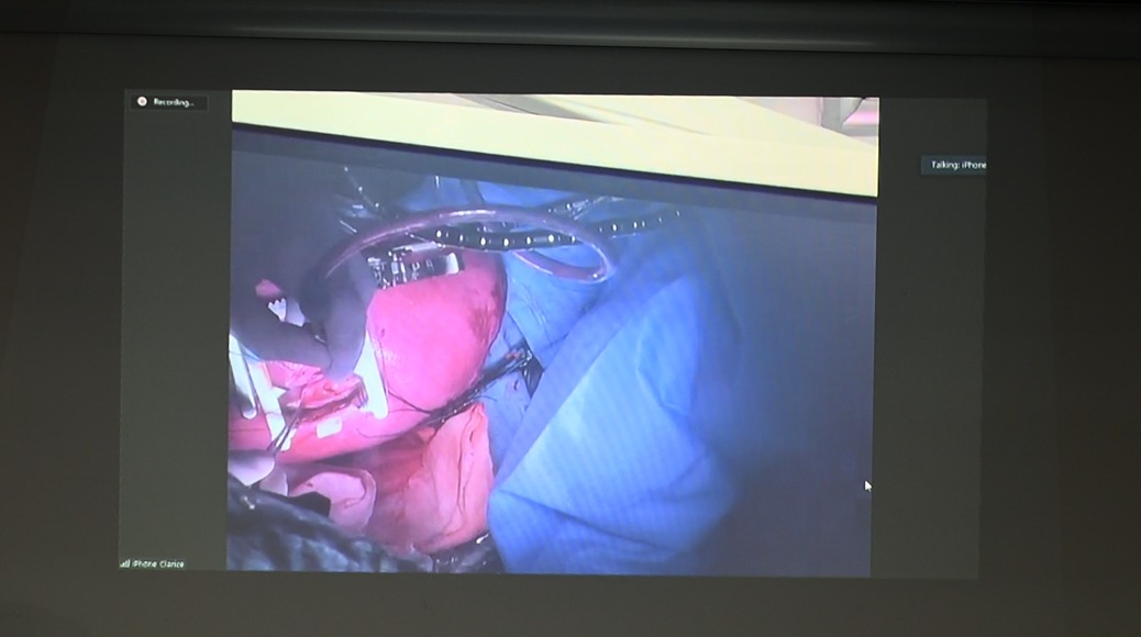 Um telão mostra um trecho de uma cirurgia intrauterina.